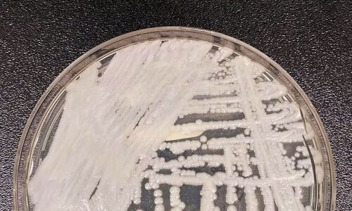 Anvisa confirma novo caso do superfungo Candida auris